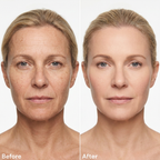 Age Reverse Cream - Lift & Repair Formula